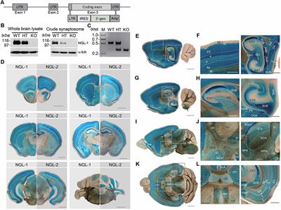 NGL-1/LRRC4C Deletion Moderately Suppresses Hippocampal Excitatory Synapse Development and Function in an Input-Independent Manner